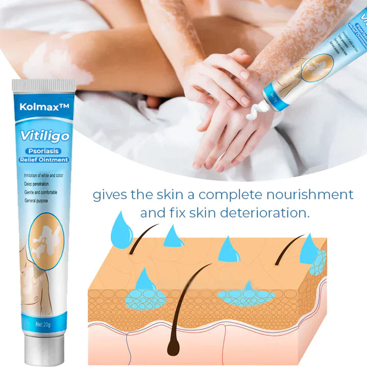 Kolmax™ Vitiligo Soothing Ointment - Glimpse Cosmetics