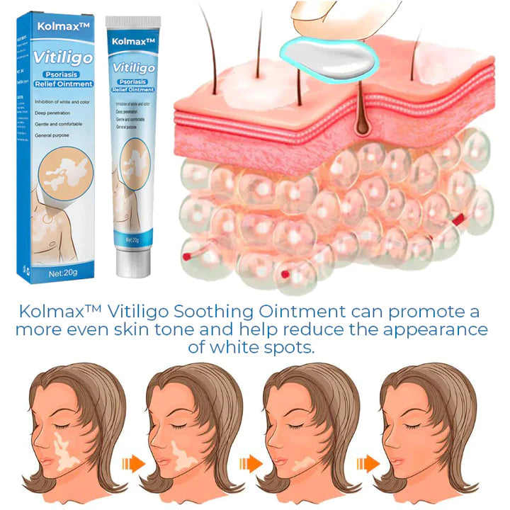 Kolmax™ Vitiligo Soothing Ointment - Glimpse Cosmetics