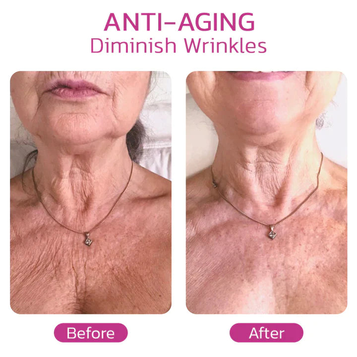 NECKPON® | Hydrolized Collagen Neck Cream - Glimpse Cosmetics